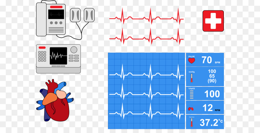 Monitor Cardíaco，Ecg PNG