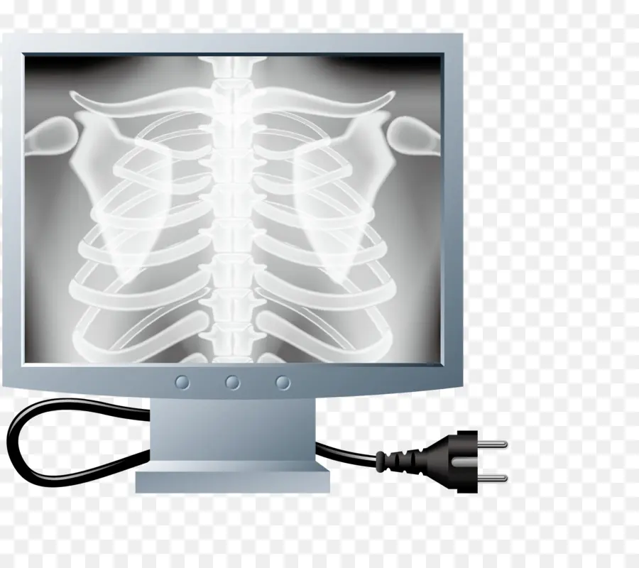 Monitor De Raios X，Costelas PNG