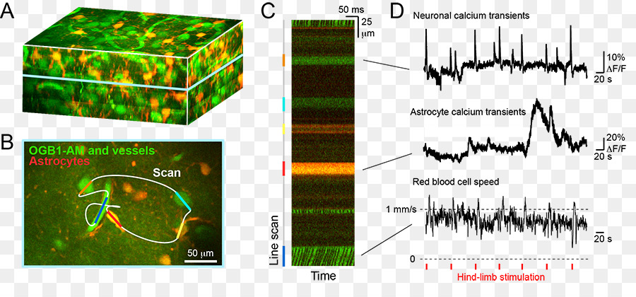 Atividade Neuronal，Cérebro PNG