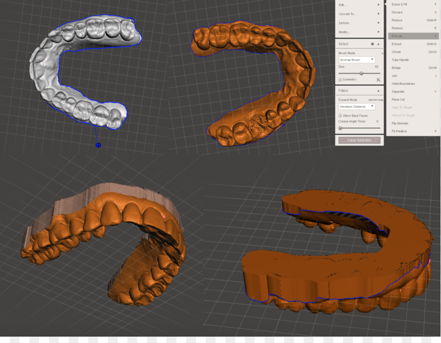 Cerec，Impressão 3d PNG