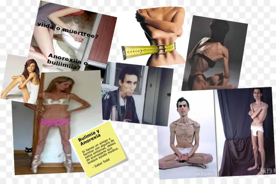 Anorexia E Bulimia，Transtorno Alimentar PNG