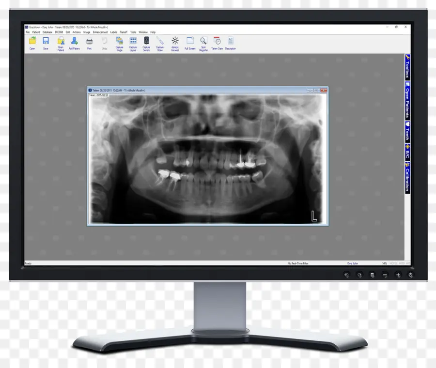 Radiografia Dentária，Dentes PNG