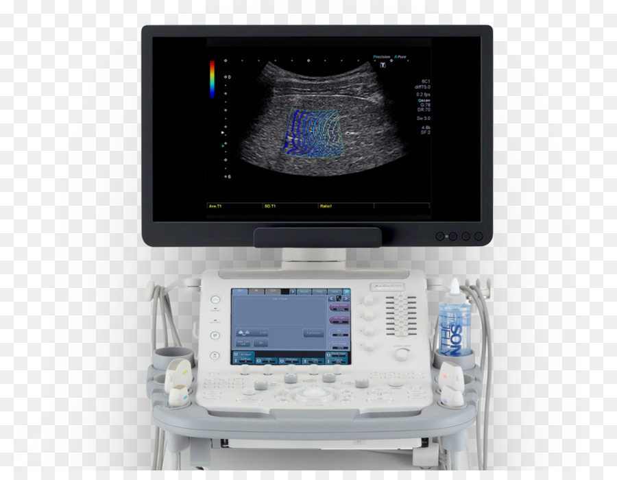 A Ultra Sonografia，Equipamentos Médicos PNG