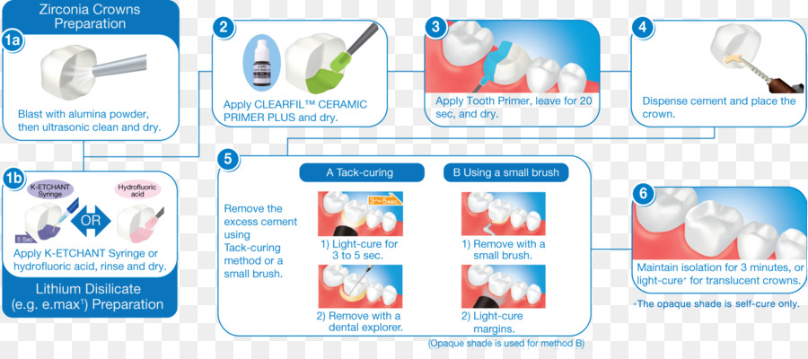 Cimento，Dental Composto PNG