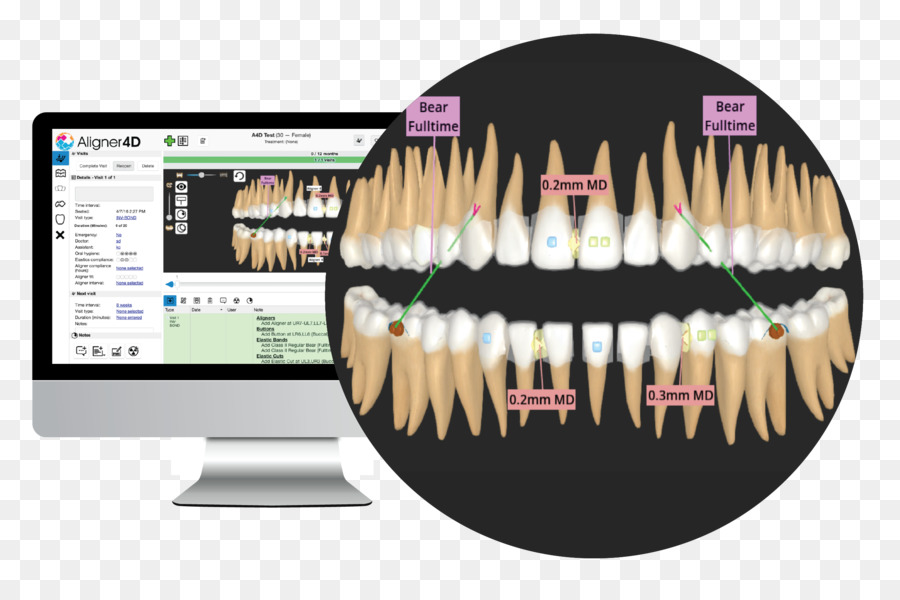 Software Odontológico，Dentes PNG