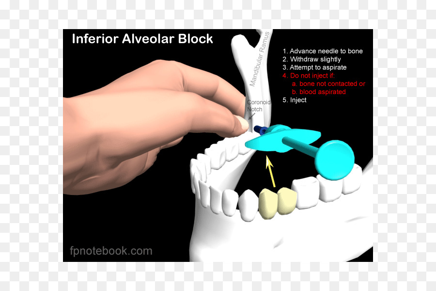 Bloco Alveolar Inferior，Dental PNG