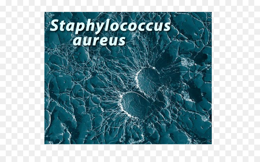 Staphylococcus Aureus，Bactérias PNG