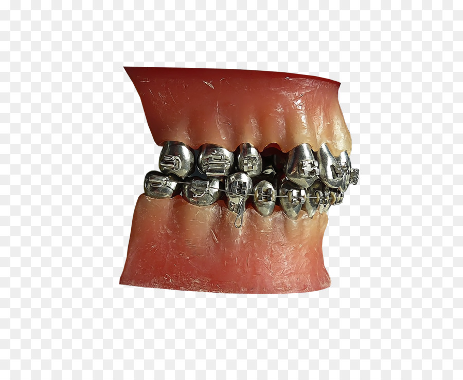 De Dentes Humanos，Dente PNG