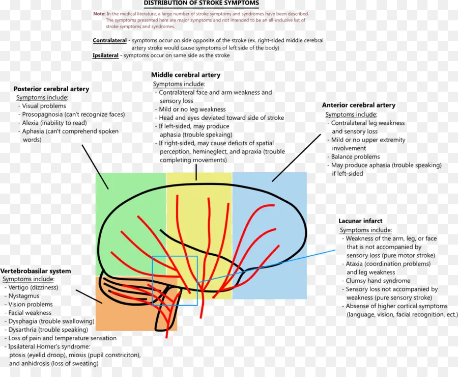 Diagrama Cerebral，Avc PNG