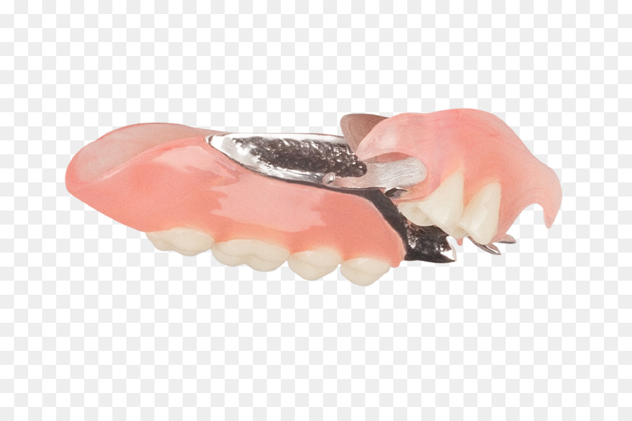 Prótese Parcial Removível，Dentaduras PNG