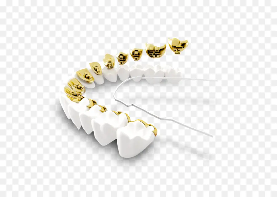 Dentes De Ouro，Dental PNG