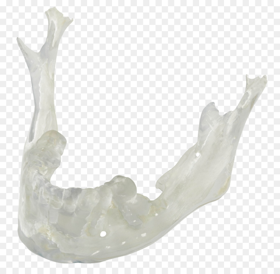 Dental Crafters Inc，Impressão 3d PNG