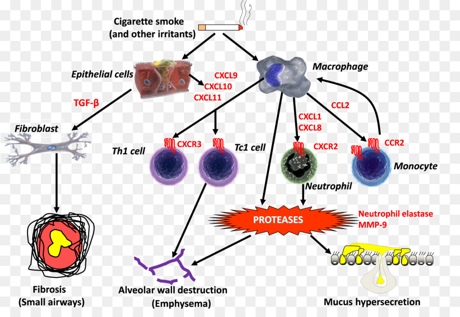 Doença Pulmonar Obstrutiva Crônica，A Inflamação PNG