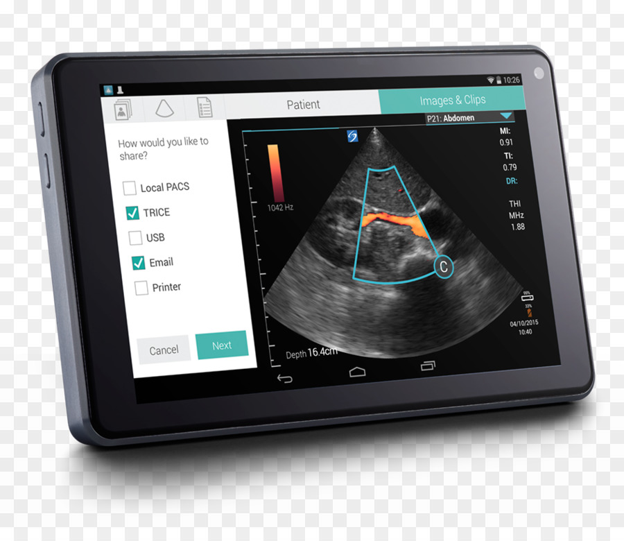 Sonosite Inc，A Ultra Sonografia PNG