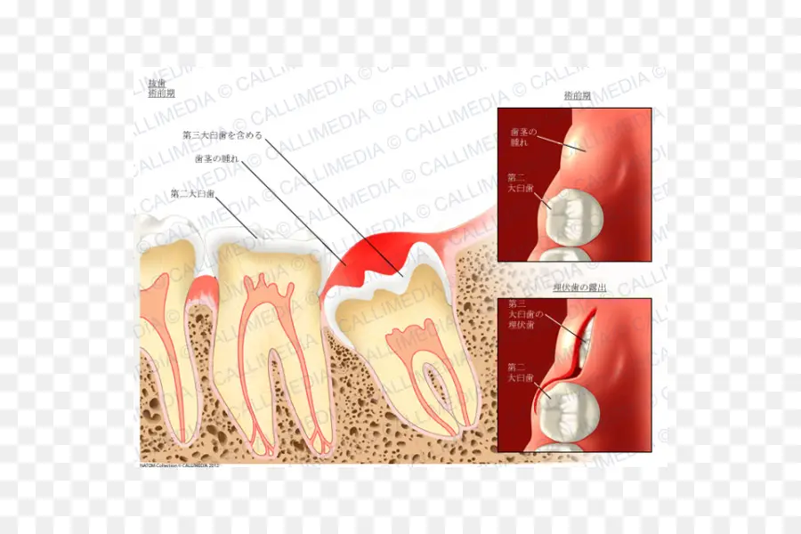 Dente，Dental PNG