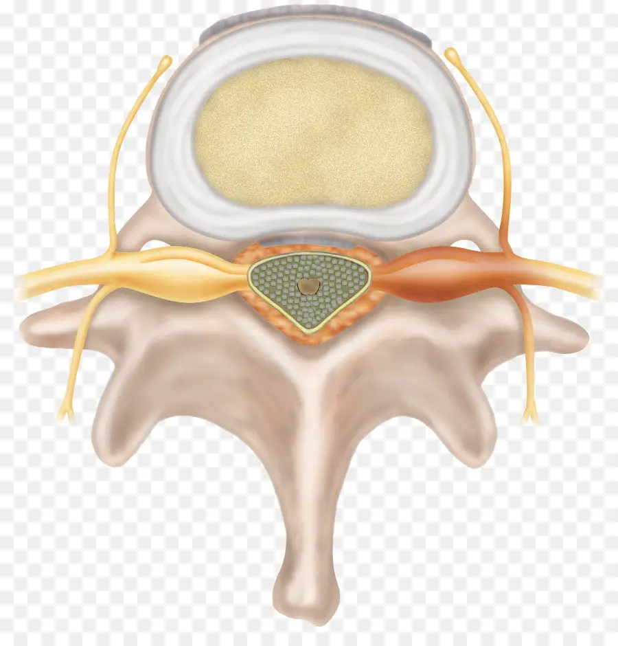 Vertebral Hérnia De Disco，Disco Intervertebral PNG