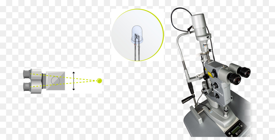 O Laser De Ndyag，Capsulotomy PNG