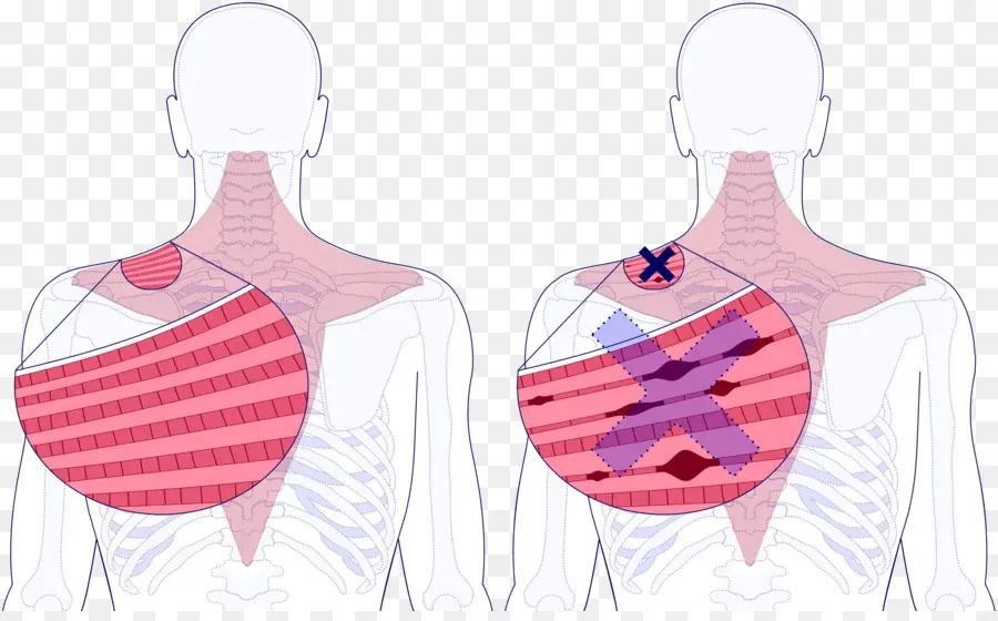 Diagrama Pulmonar，Pulmões PNG