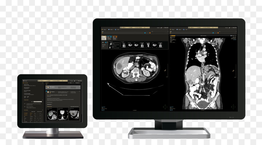 Arquivamento E Comunicação De Imagens Sistema，Philips PNG