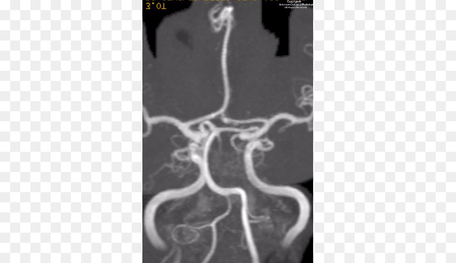 Imagens Médicas，Radiologia PNG