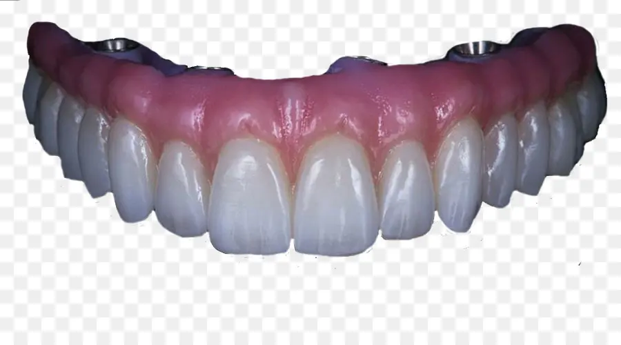 Dentaduras，Dentes PNG