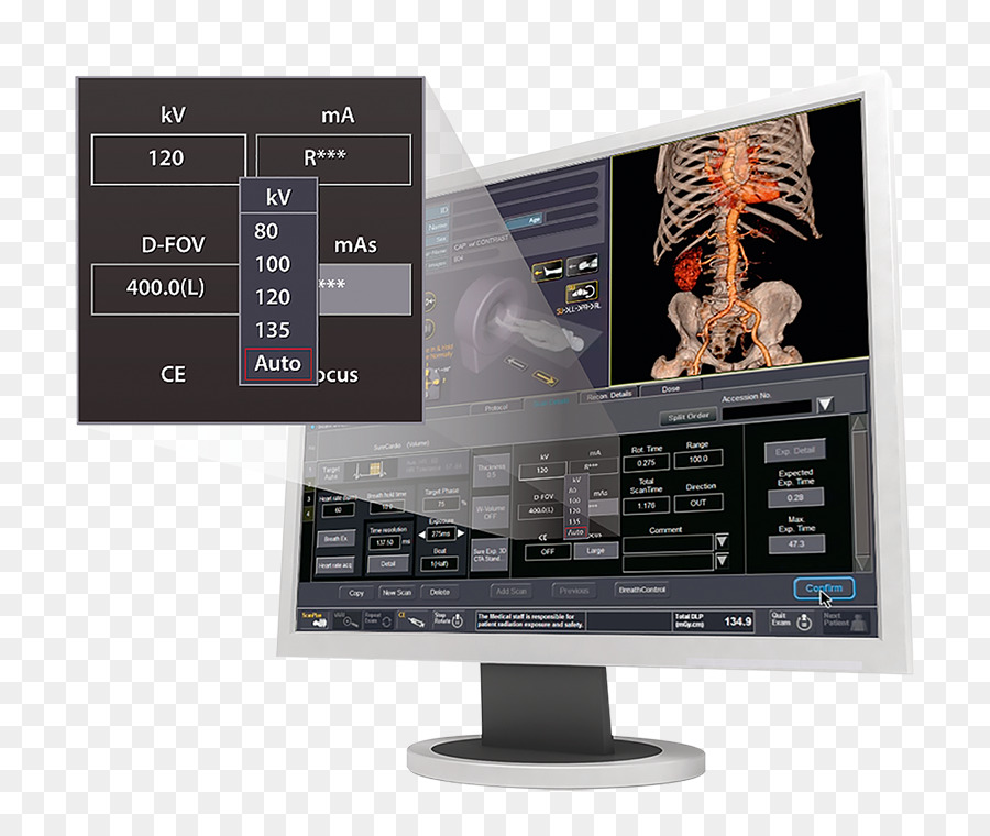 Monitores De Computador，Canon Medical Systems Corporation PNG