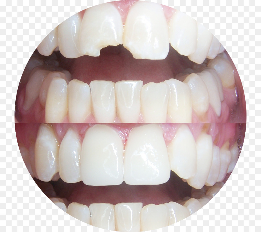 Dente，Odontologia PNG
