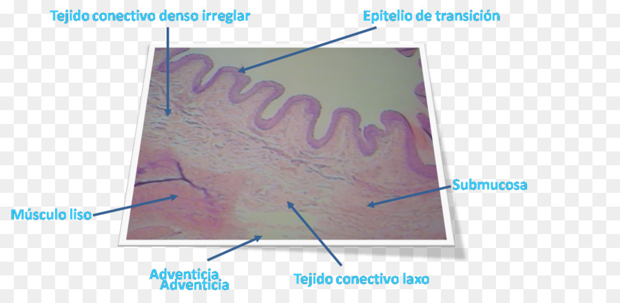 Bexiga Urinária，Submucosa PNG