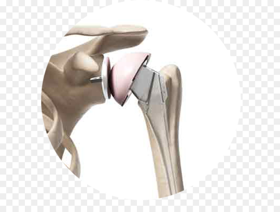 Substituição Do Ombro，Cirurgia PNG