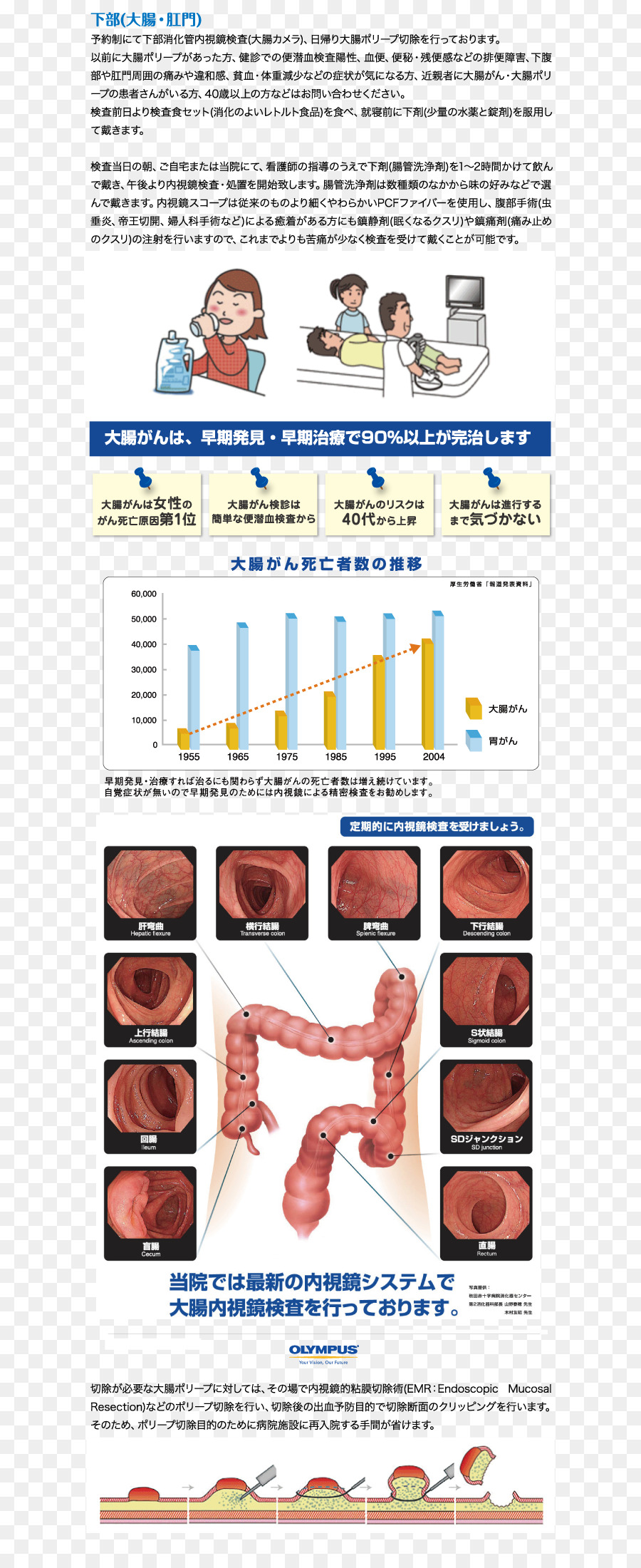 Chigasaki，Endoscopia PNG