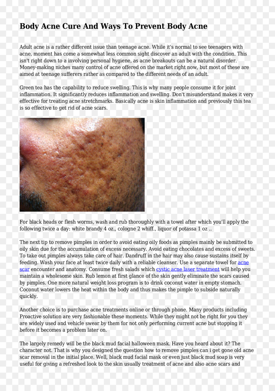 Acne，Cicatriz PNG