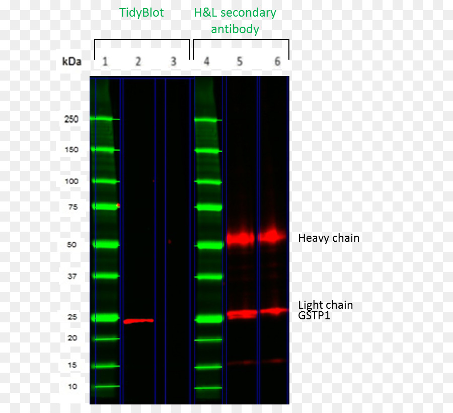 Imunoglobulina G，Western Blot PNG