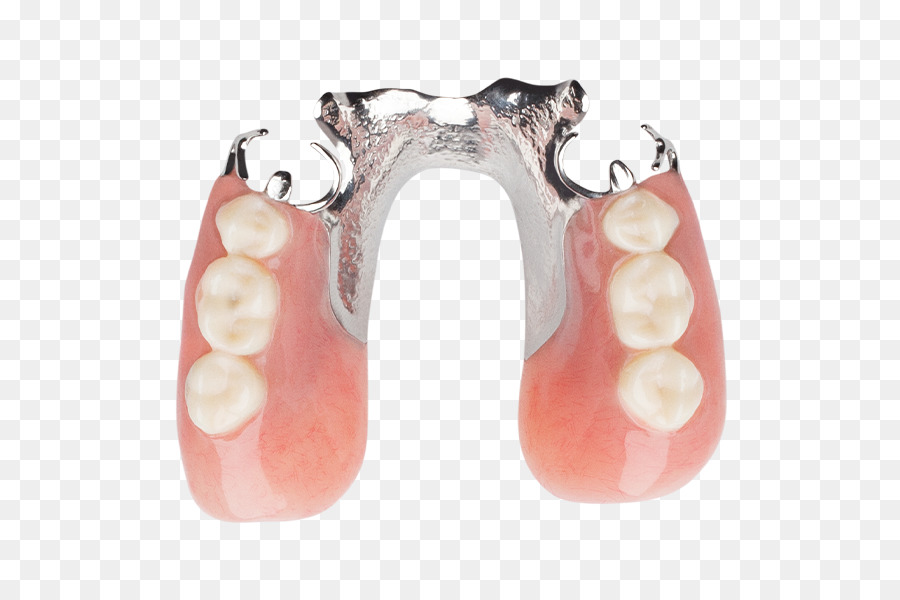Dente, Dentaduras, Prótese Parcial Removível png transparente grátis