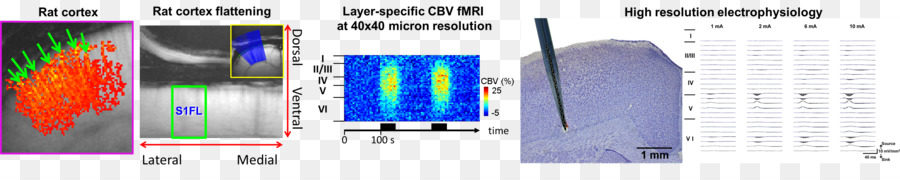 Imagens De Ressonância Magnética Funcional，Laboratório PNG