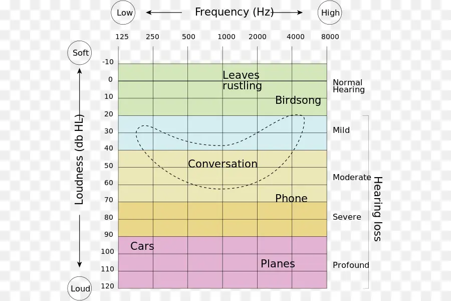 Gráfico De Perda Auditiva，Freqüência PNG