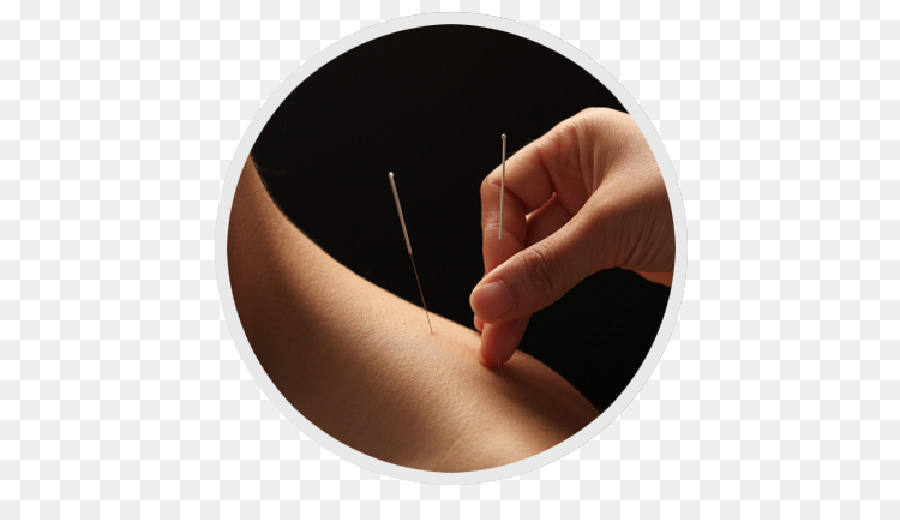 Acupuntura，Terapia PNG