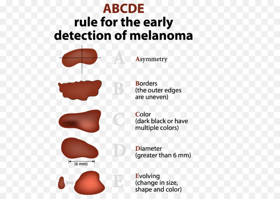 Detecção De Melanoma，Pele PNG