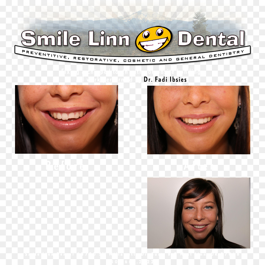 Lake Oswego，Sorriso Linn Dental Ibsies Fadi B Dmd PNG