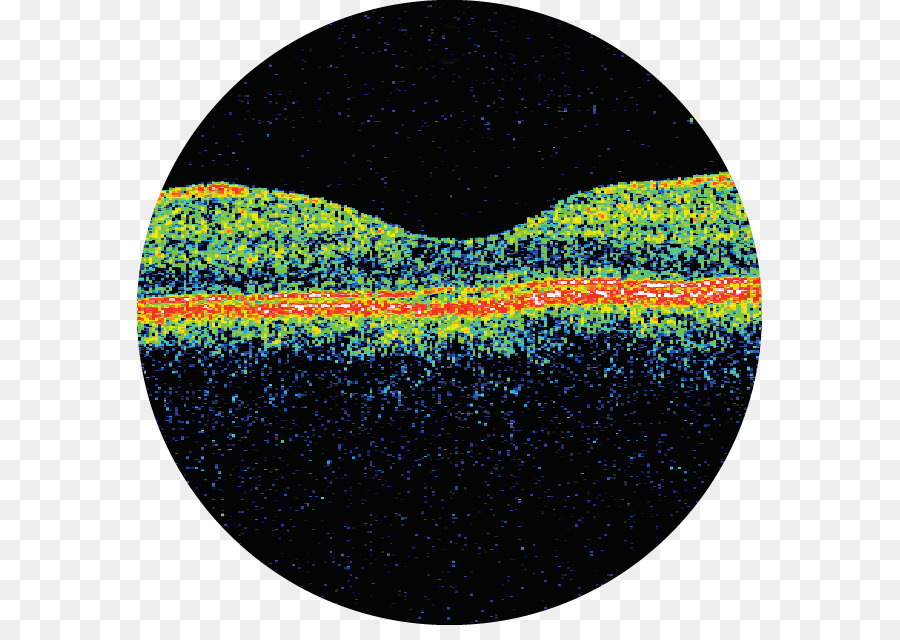 Astha Hospital，Optical Coherence Tomography PNG