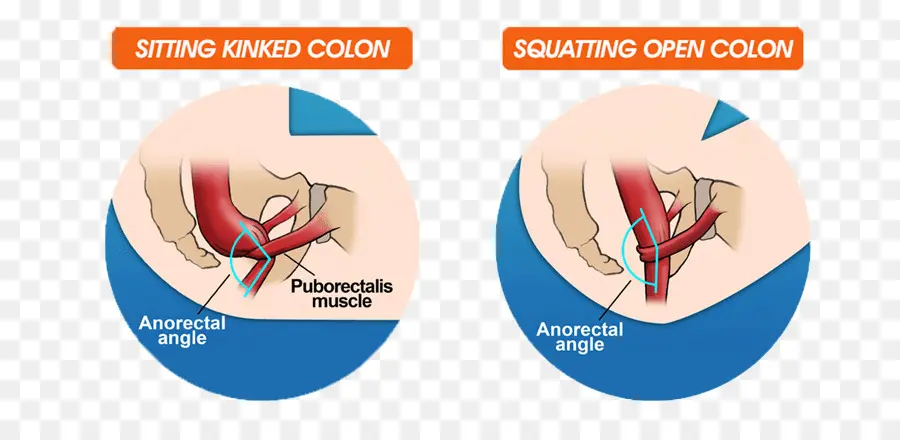 Diagrama De Dois Pontos，Sentado PNG