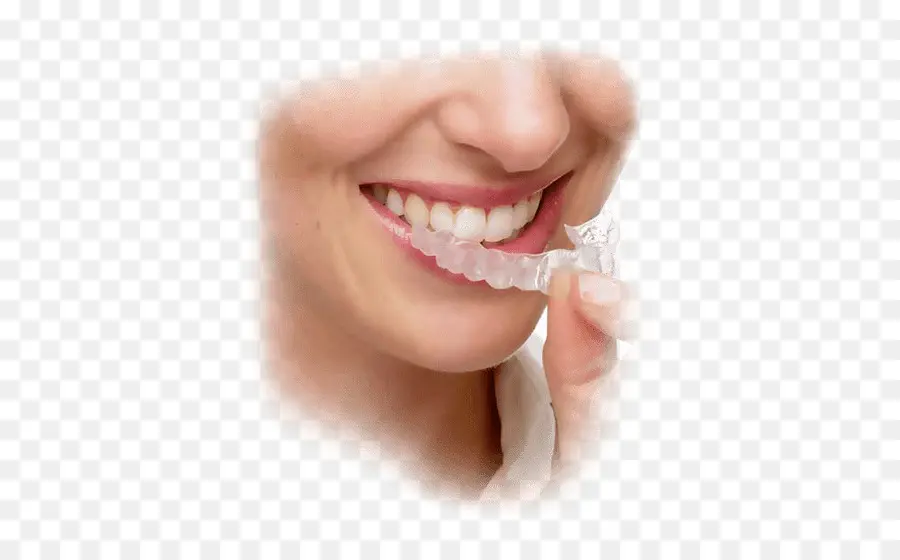 Alinhador Transparente，Dentes PNG