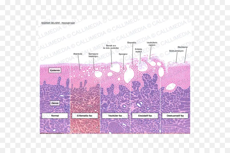 Histologia，Keratinocyte PNG