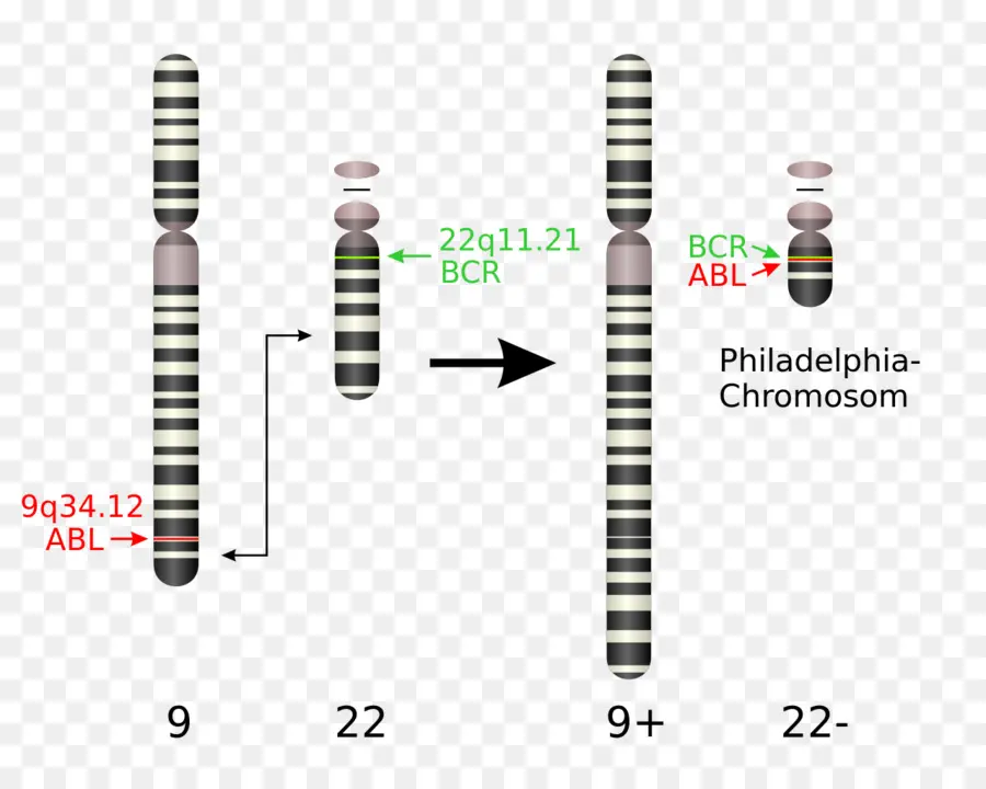O Cromossoma Filadélfia，Translocação Cromossômica PNG