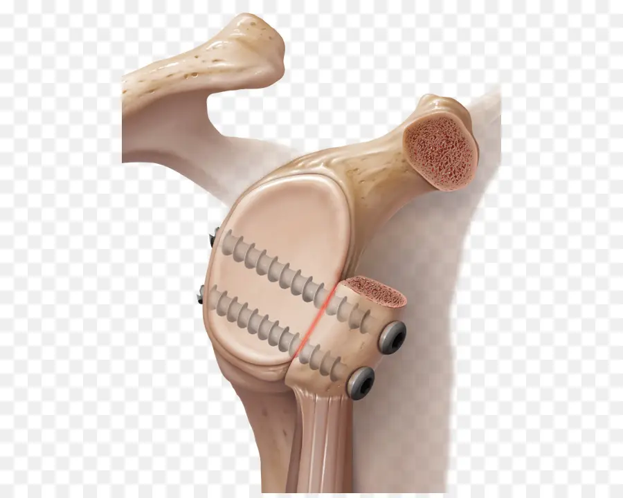 Articulação Do Ombro，Osso PNG