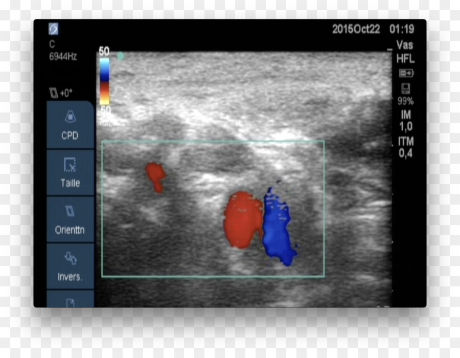 Federal Centro De Diagnóstico De Laboratório Médico，Doppler Ecocardiografia PNG