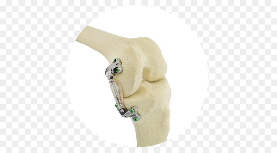 Joelho，A Osteoartrite PNG