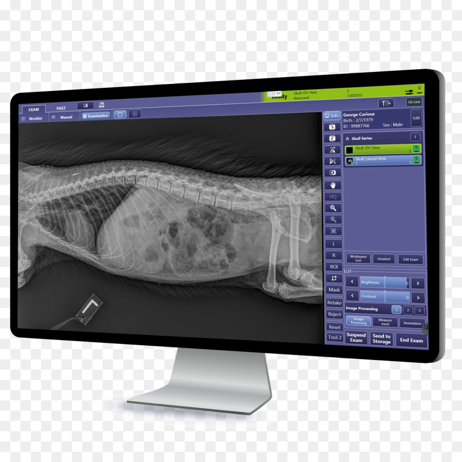 Radiografia Digital，Canon PNG