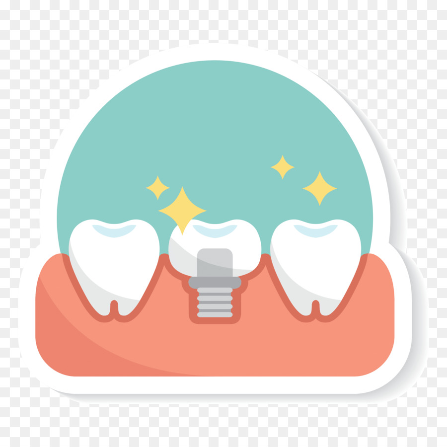 Implante Dentário，Dentes PNG