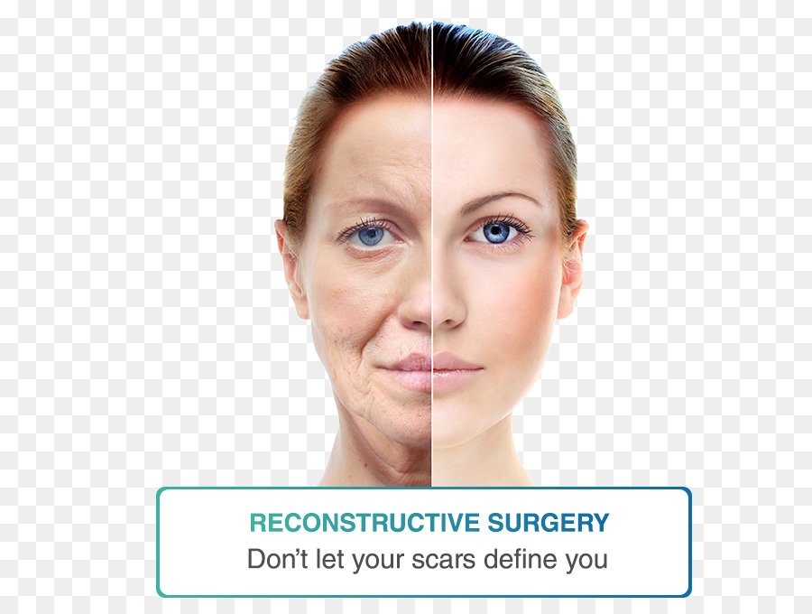 Cirurgia Reconstrutiva，Face PNG