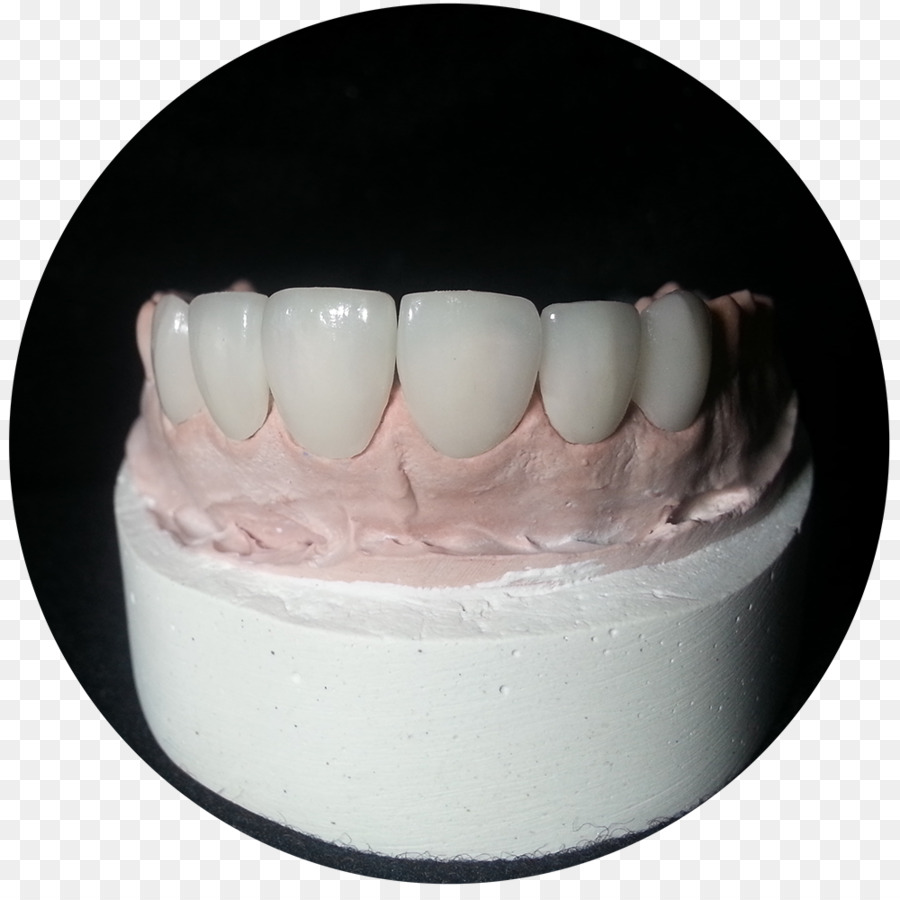 Viax Dental Panamá，Cerâmica PNG